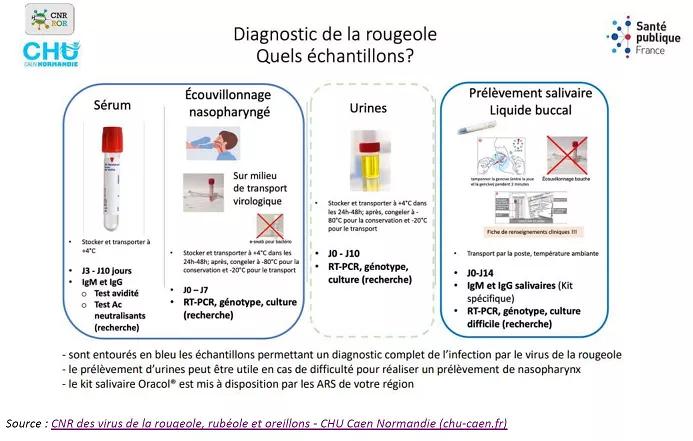 Prélèvement rougeole